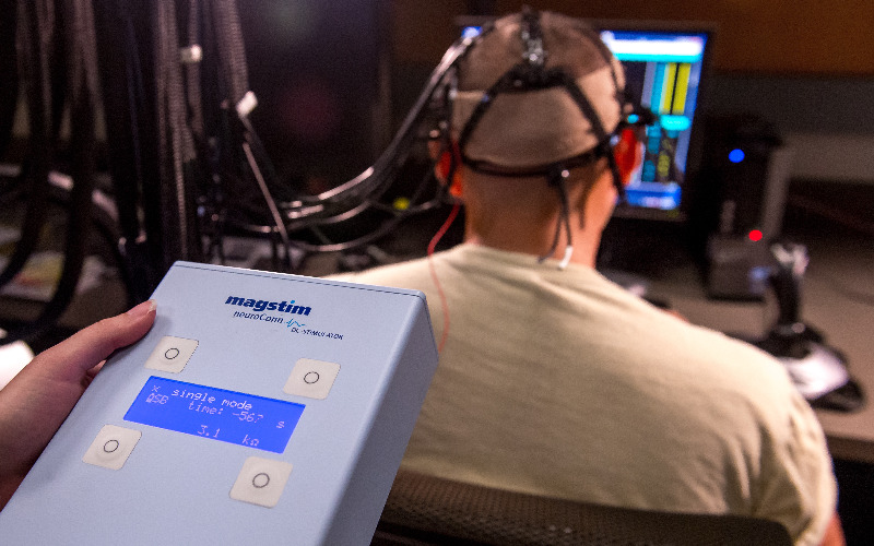 تحریک الکتریکی مغز tdcs