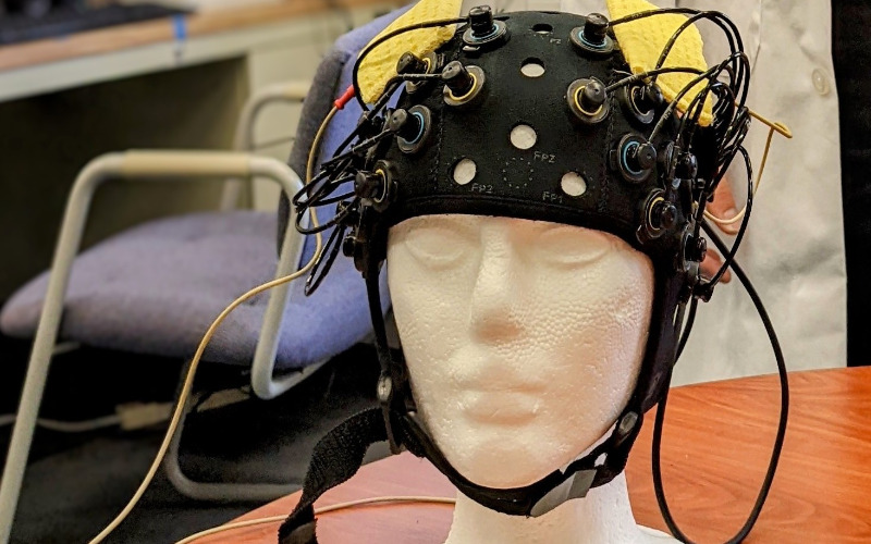تحریک الکتریکی مغز tdcs